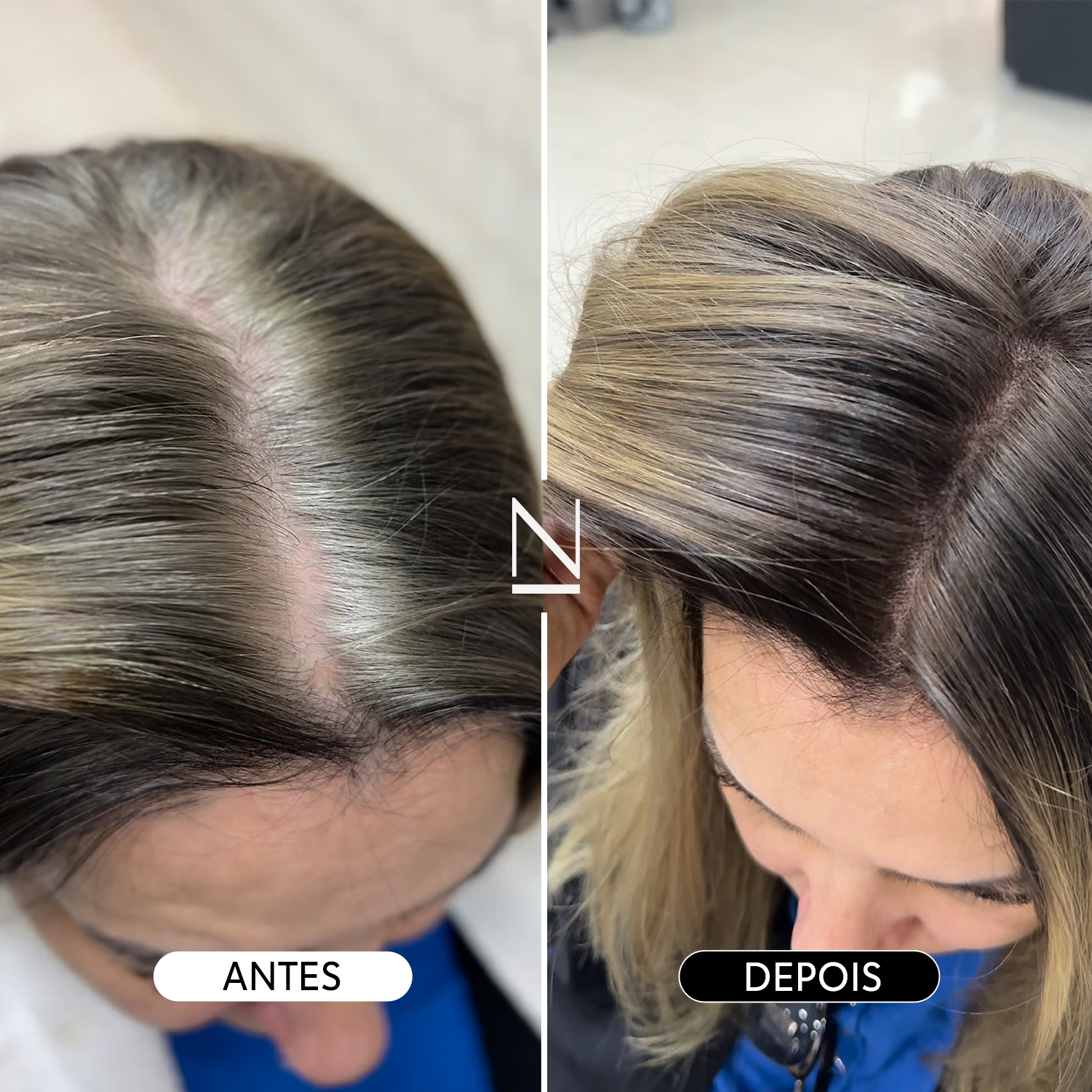 Kit Camuflage Medium Black Friday